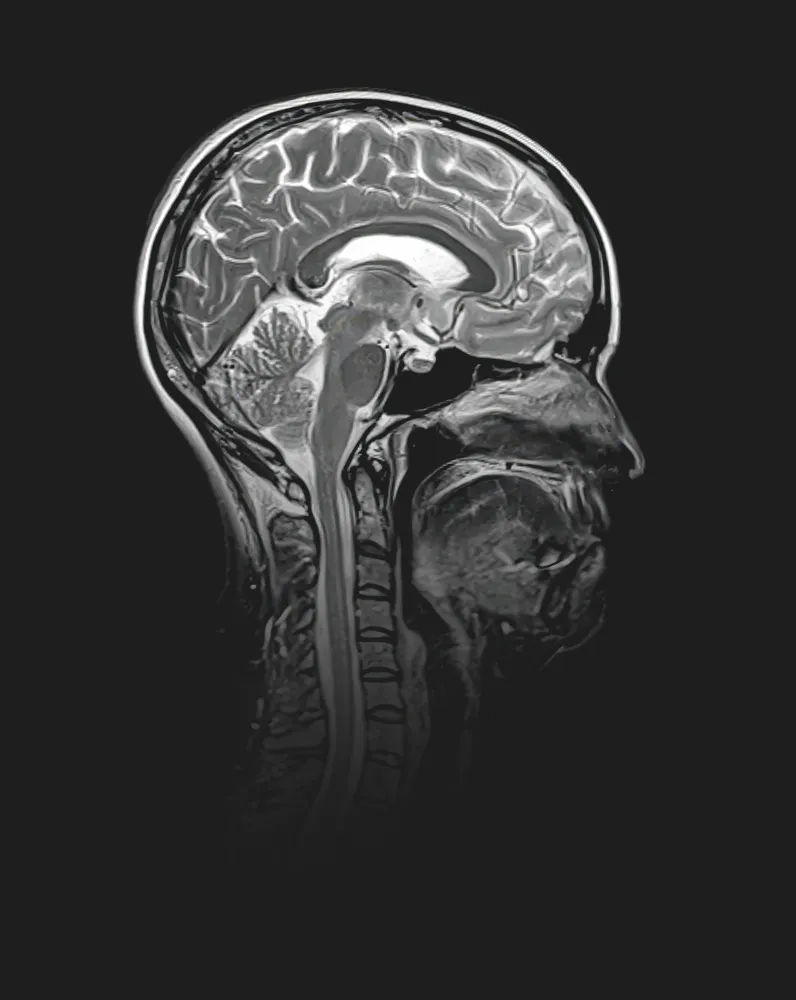 Brain Injuries & Concussions